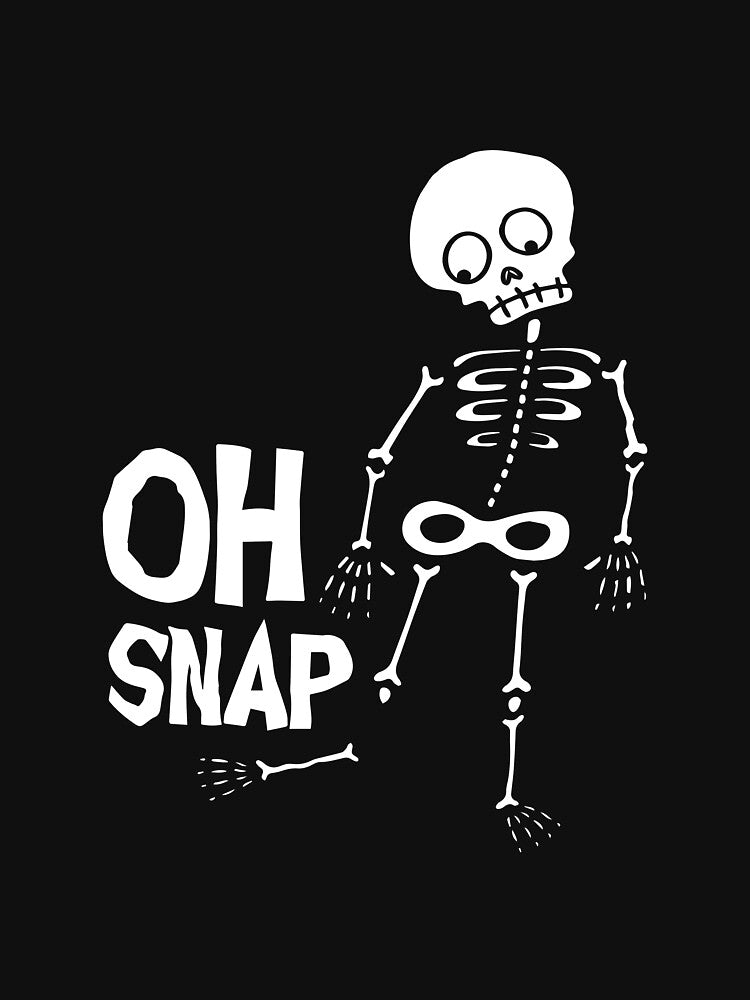 OH SNAP! broke my skele-leg. by Holwayout